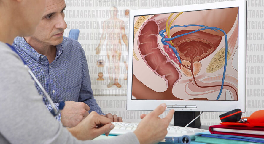 A healthcare provider educates a patient about the male reproductive system and prostate health using a detailed anatomical diagram.