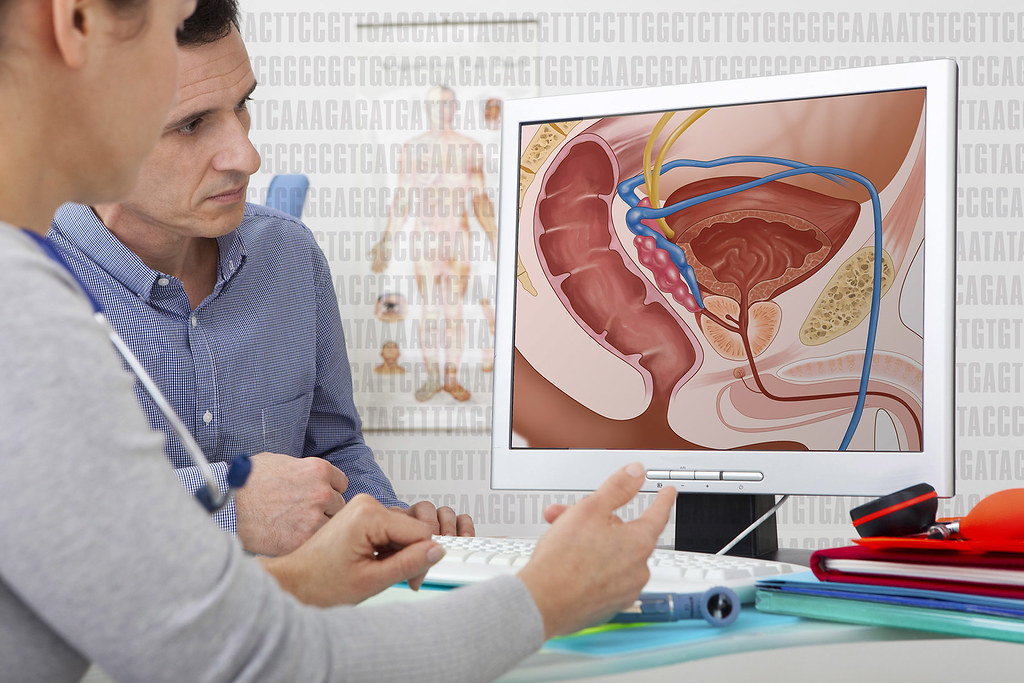 A healthcare provider educates a patient about the male reproductive system and prostate health using a detailed anatomical diagram.