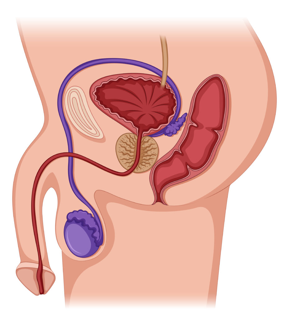 Male reproductive and urinary system illustration highlighting the prostate gland and associated structures.